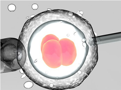 卵泡萎缩是什么？卵泡萎缩可以做试管婴儿吗？
