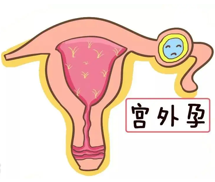 1660826302299961.png