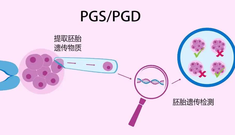 长沙三代试管包生男孩价格贵吗？三万块能做成功吗？