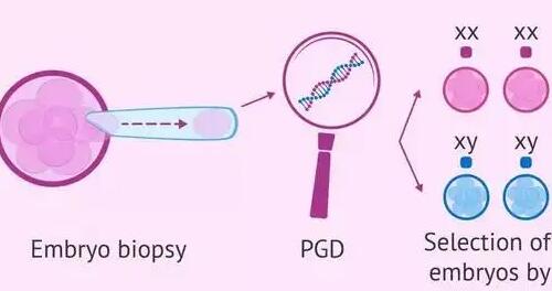 三代试管选女孩出错几率大吗？附详细准确率