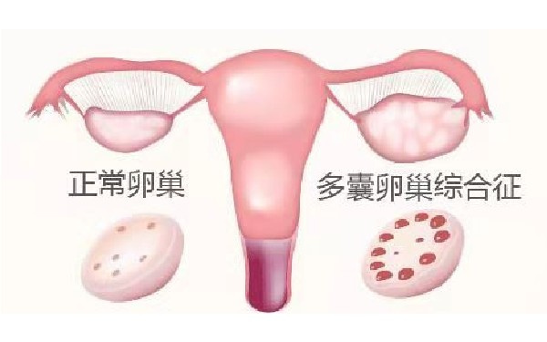 重庆妇幼保健院做试管婴儿费用多少？可以做供卵试管吗