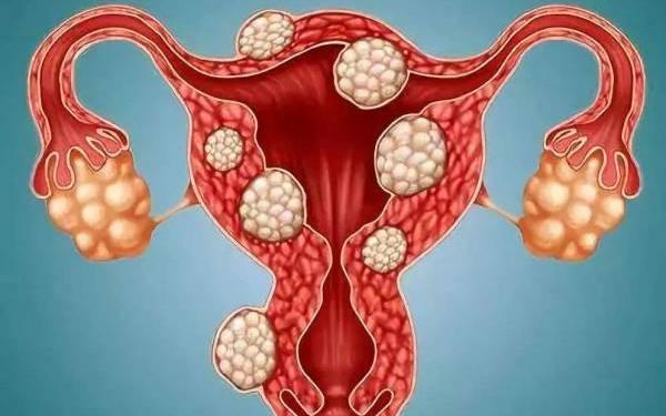 卵巢衰竭可以做供卵试管吗？这四个条件必须满足