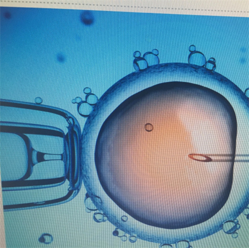 卵巢早衰可以做供卵试管吗？影响试管成功率的因素是什么？