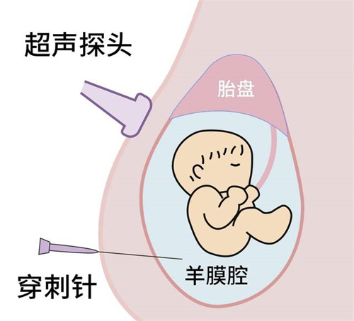 广西桂林南溪山医院做试管婴儿怎么样 桂林试管婴儿医院有哪些