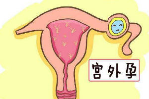 上海能做供卵试管的医院有哪些？做供卵试管的步骤是什么？