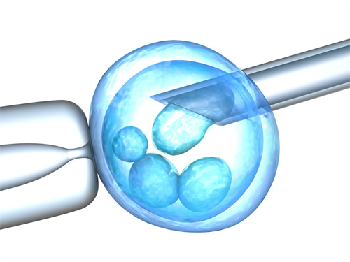多囊卵巢综合症可以提供卵子吗？附供卵质量评估分享