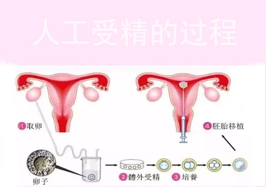 人工受精的过程