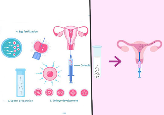 人工受精和人工授精有什么区别?