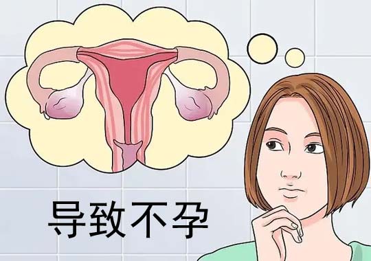 子宫内膜异位症为什么会导致不孕?