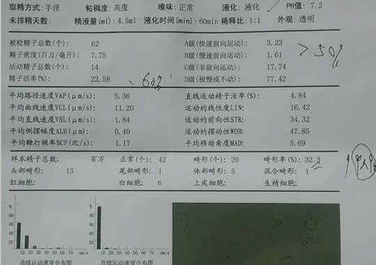 一般精液检查报告单常见问题