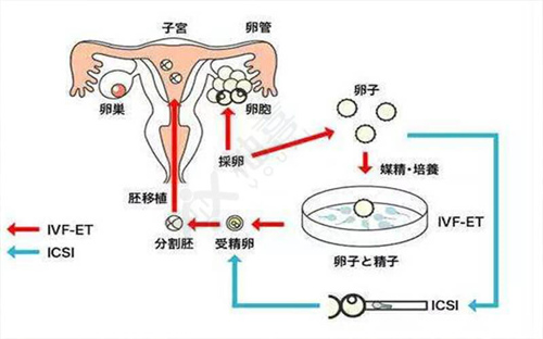 昆华医院试管三代流程是怎样的？附昆华医院试管婴儿收费明细！