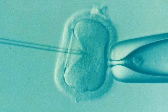 试管婴儿单胎和双胎费用一样吗？孕早期怎么判断单胎还是双胎？