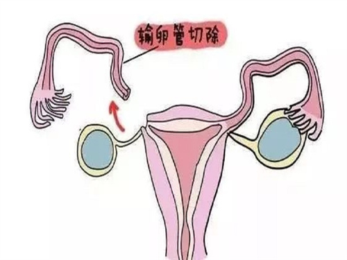 上海试管婴儿高龄胚胎移植流程介绍 上海私立供卵机构到底靠不靠谱
