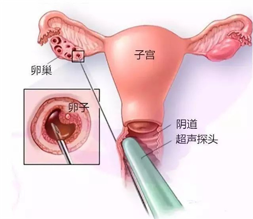 48岁绝经做供卵试管成功率高不高？做试管婴儿对女性身体有什么影响？