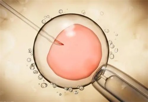 2023年长沙哪家医院可以做供卵试管婴儿？长沙去哪做供卵试管？