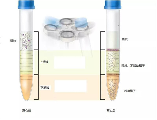 广州试管婴儿医院排名最好的医院 附广州试管婴儿费用参考