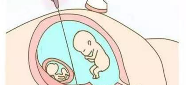 试管怀三胞胎和减胎哪个的风险更大？