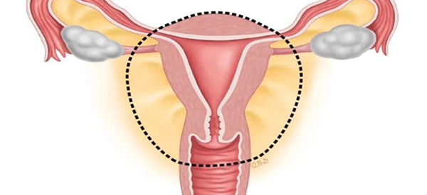 宫颈刮片和tct在准确率方面有什么区别？