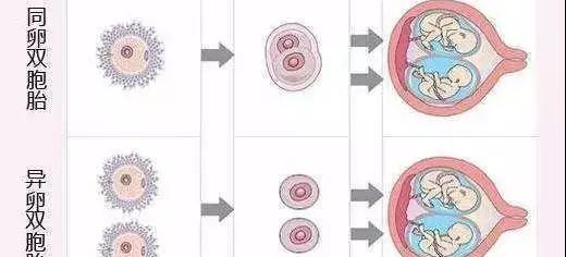 别想着怀双胞胎了，关于多胎妊娠风险80%的孕妇不知道！