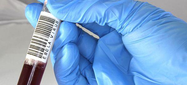 成人第二次打甲肝疫苗前必须要做的检查有哪些？