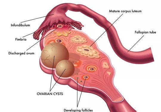 做试管婴儿胚胎停育、空孕囊，都是怎么一回事？