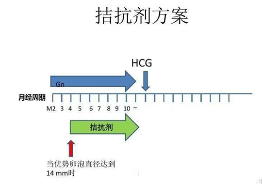 试管婴儿拮抗剂方案优缺点