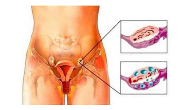 卵巢功能下降有那些征兆？