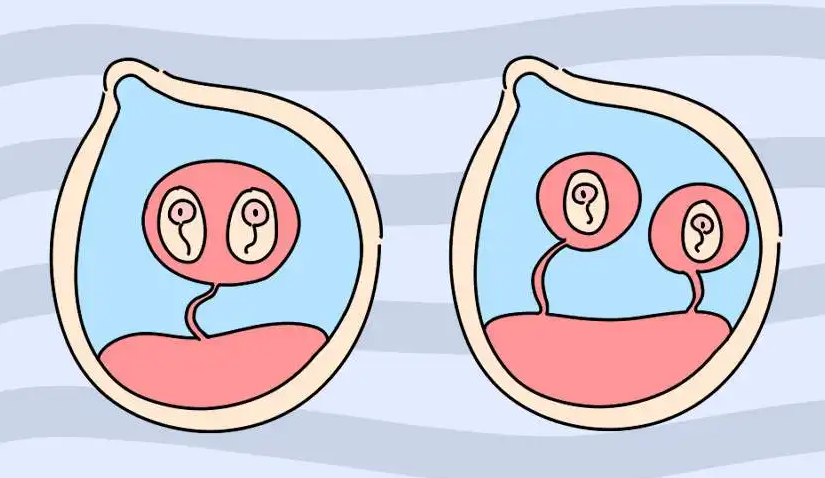 做试管婴儿移植两个胚胎就能要双胞胎吗？