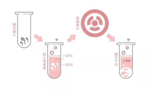 泰国能给否给hiv患者洗精，要注意哪些事情