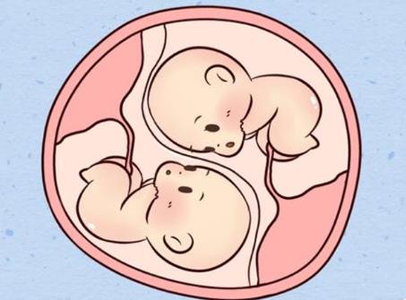 美国做试管婴儿生双胞胎费用要多少钱?3万美元够吗？