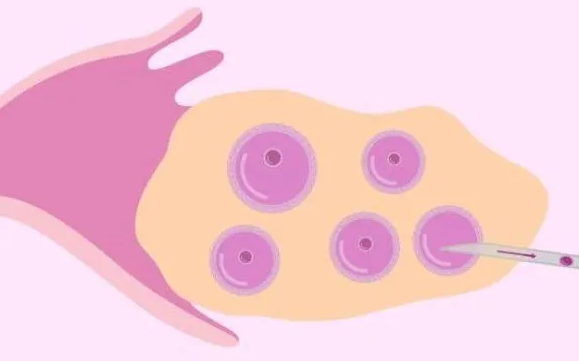 卵泡少对试管婴儿有什么影响？卵泡少应该怎么调节