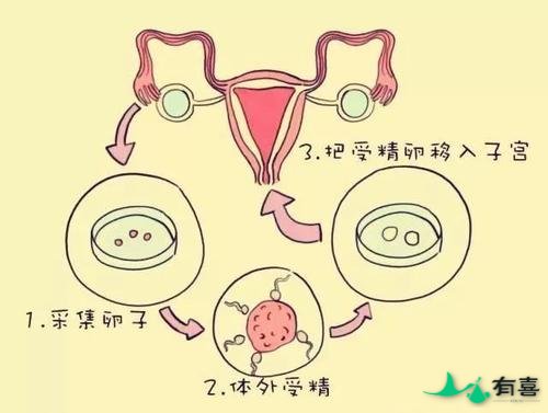 马来西亚第三代试管婴儿适合哪些人