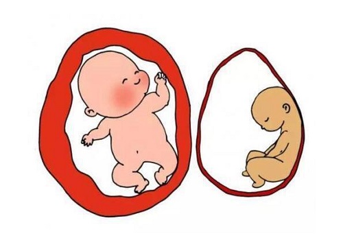 试管婴儿想生双胞胎就能生?试管婴儿生双胎很简单吗?