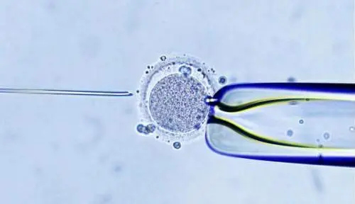 胚胎移植腹水有哪些症状？试管腹水正确处理方法