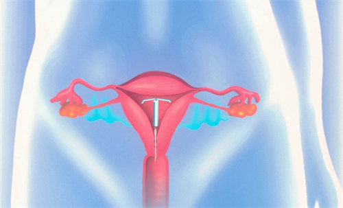 为什么试管胚胎移植前要憋尿？胚胎移植前怎么憋尿比较好