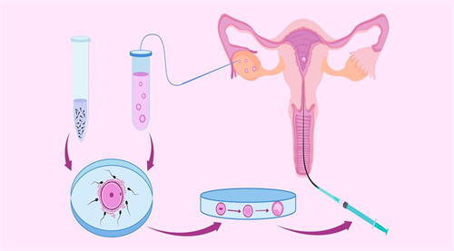 分析三代试管移植不成功的原因！为什么三代试管移植反复不着床