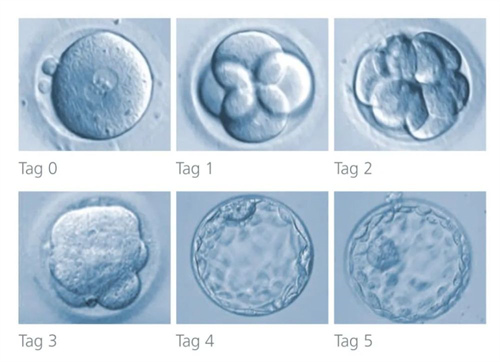二代试管婴儿移植条件要满足哪些？胚胎质量达标只是其一