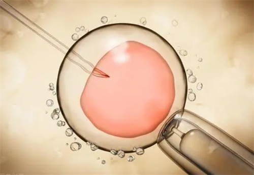 试管取卵有腹水多久可以移植？试管婴儿取卵后多久可以移植