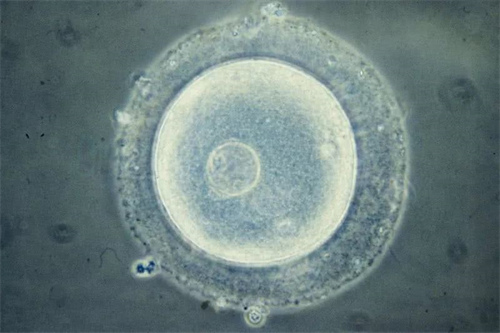 试管婴儿移植几个胚胎更容易成功？解析移植一个胚胎的几个好处