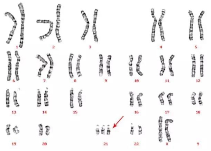 宫腔粘连怀孕后要注意的事
