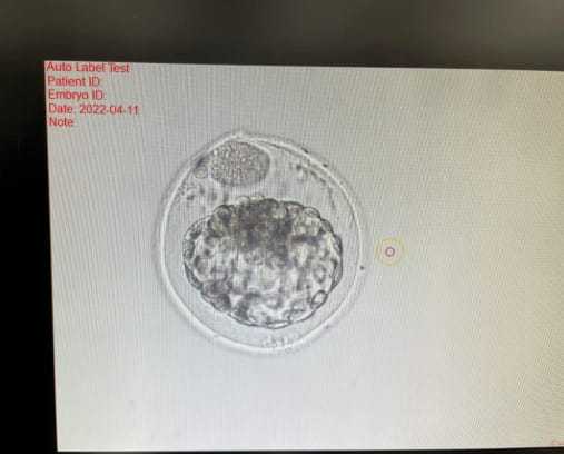 多囊卵巢怎么吃比较好插图 多囊卵巢怎么吃比较好插图