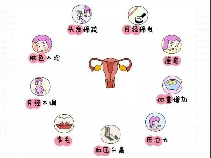 多囊卵巢综合征做试管婴儿前需要知道的事插图 多囊卵巢综合征做试管婴儿前需要知道的事插图