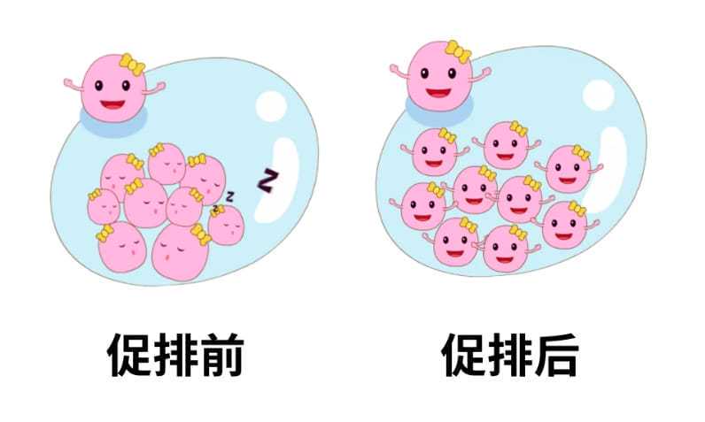 冷冻精子要花多少钱？用冷冻精子做试管成功率高吗？插图