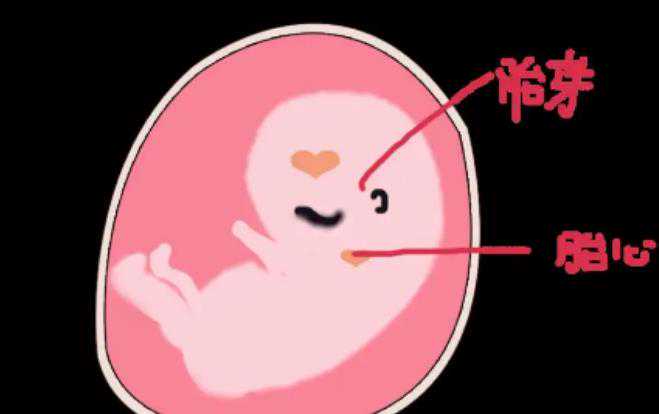 孕囊的形状可以判断性别吗？怀孕期间怎么看男女？插图