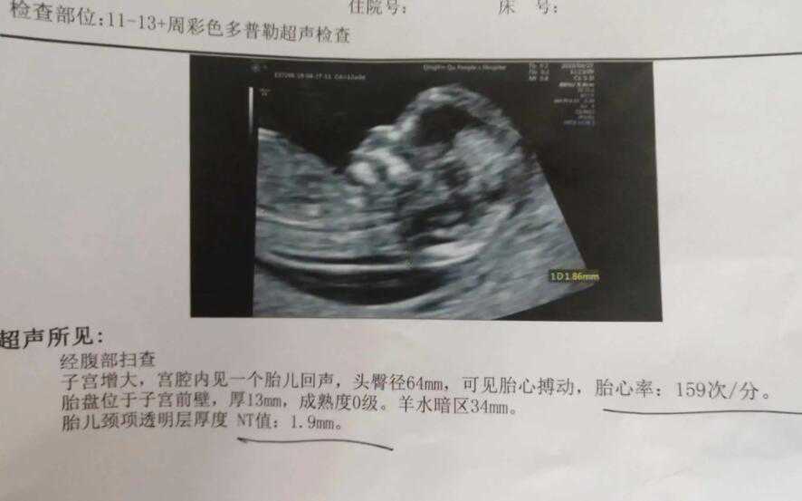nt值看男女已生验证？附详细证明解读方法插图1