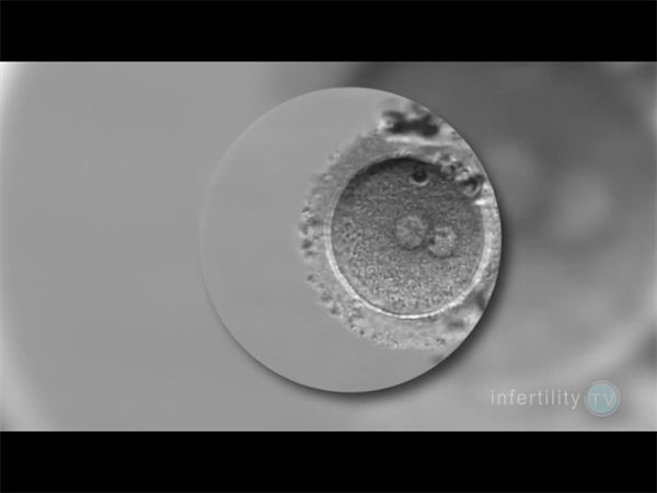泰国杰特宁医院试管婴儿成功率！影响试管婴儿成功率的因素插图