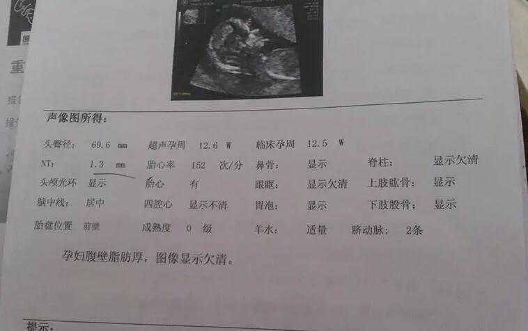 12周nt男宝特点是怎样的？nt单生男孩特征插图1