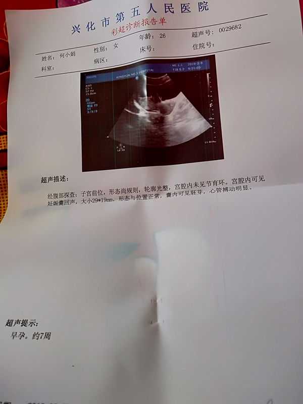 孕期彩超报告单该怎么看？生男生女彩超单上有暗示！插图1