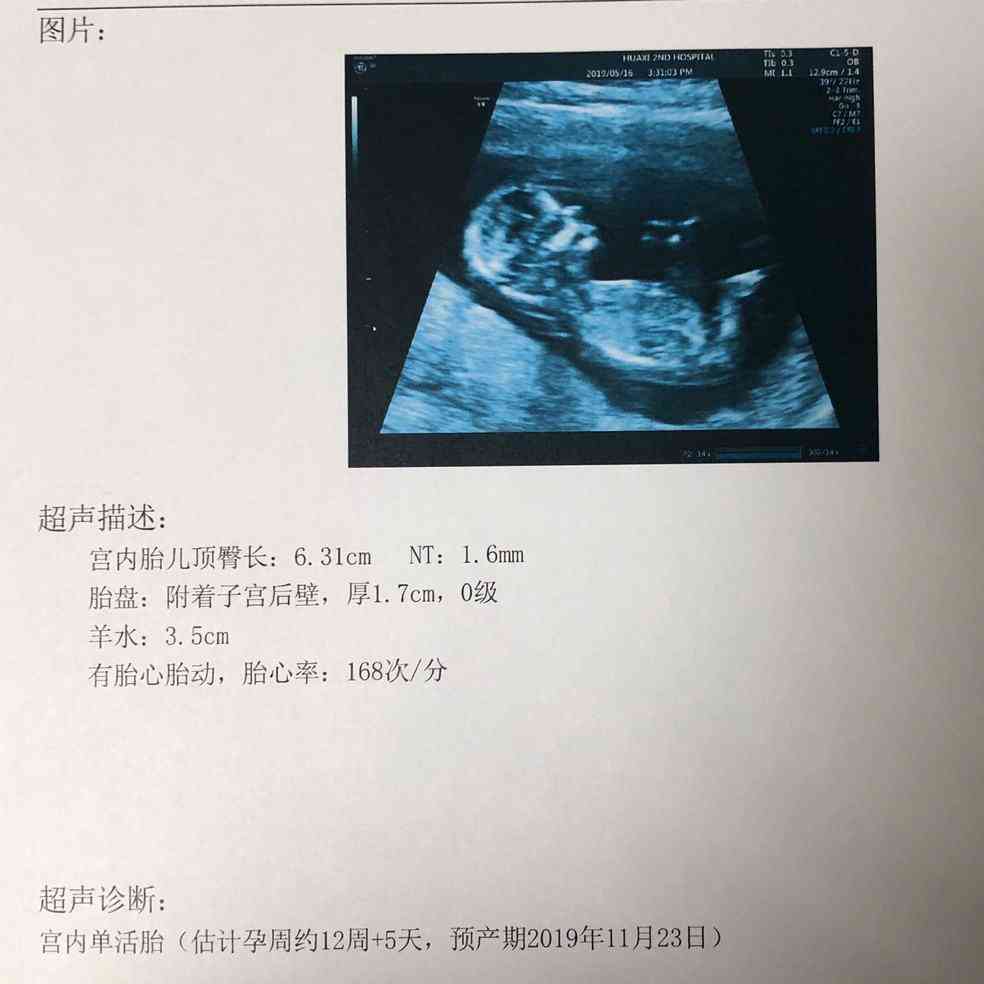 nt值看男女85%的准确率!NT哪些字母可以看男女？插图1