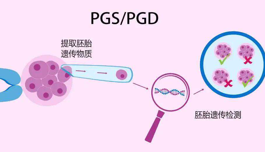 长沙三代试管包生男孩价格贵吗？三万块能做成功吗？插图2